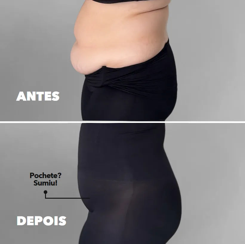 Compre 1 Leve 2 - Kit Modelador de Cintura Ultra Shaper